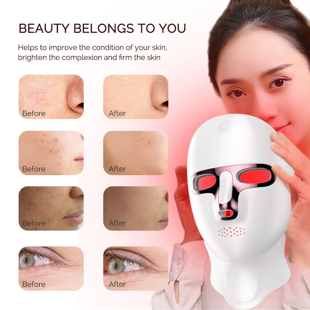 Wireless 7-Color LED Face & Neck Mask – Anti-Aging & Skin Repair